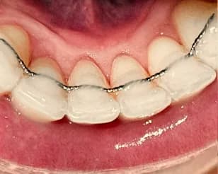 Customer photo 1 shared with a review of Dentart™ Deep Cleansing Tooth Powder, Feb 27, 2026