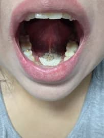Customer photo 2 shared with a review of Dentart™ Deep Cleansing Tooth Powder, Mar 9, 2026