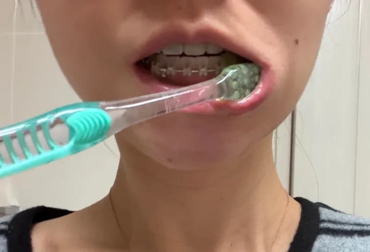 Customer photo 2 shared with a review of Dentart™ Deep Cleansing Tooth Powder, Feb 23, 2026